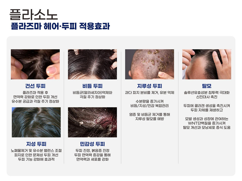 PLASONO_ppt 2024.3.25_14.jpg