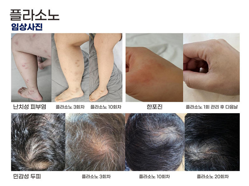 PLASONO_ppt 2024.3.25_23.jpg