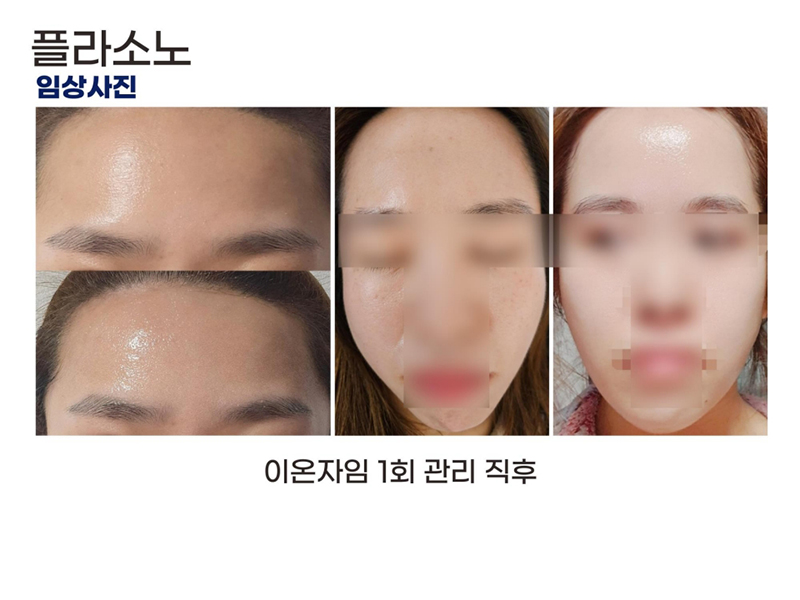 PLASONO_ppt 2024.3.25_24.jpg